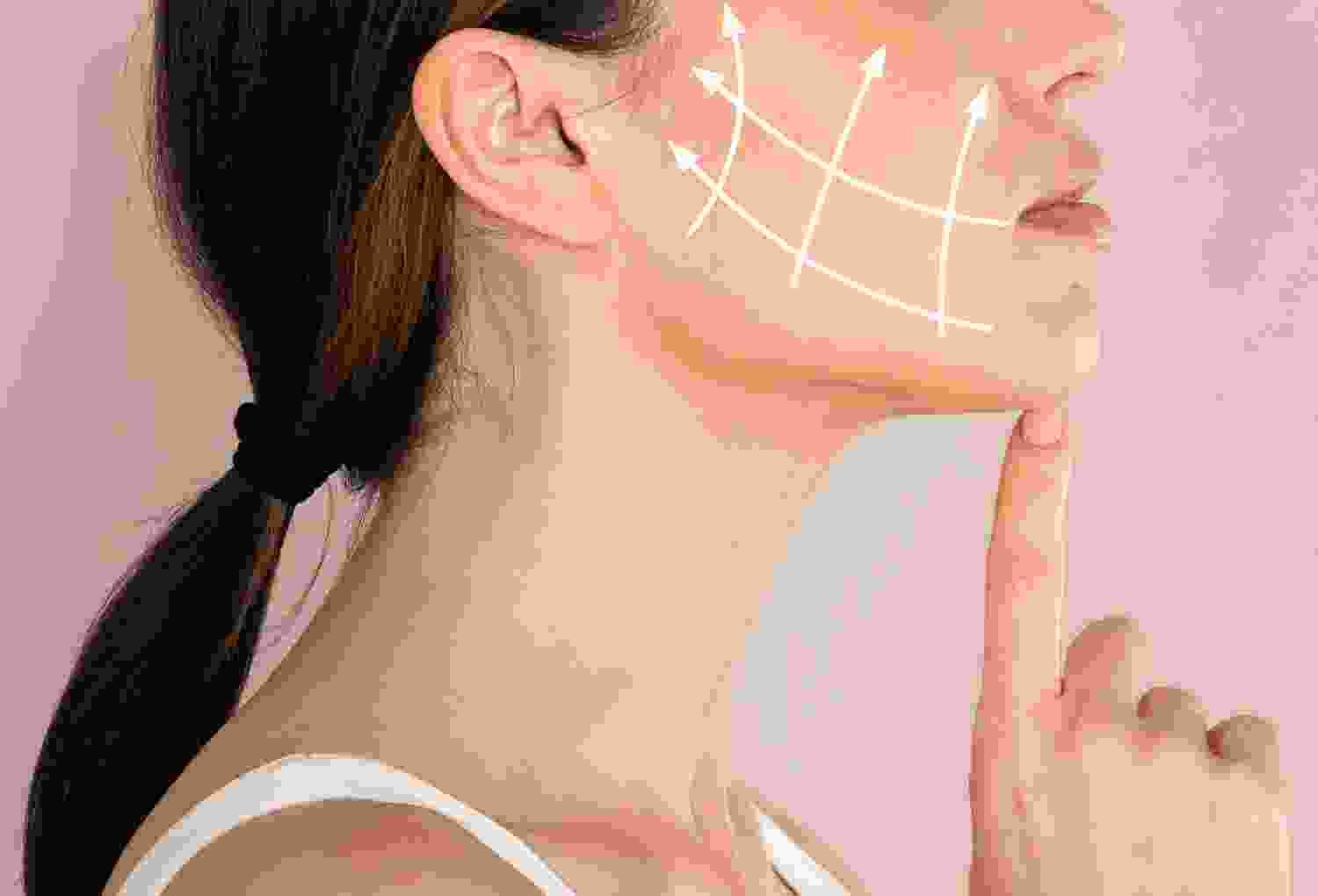 Cheek Augmentation